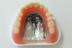 軽くて耐久性のある金属床義歯